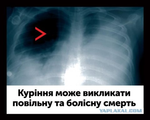 Австралийцы - курите "на здоровье