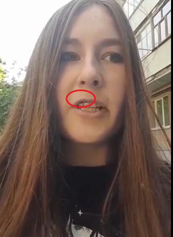 Жар под кожей