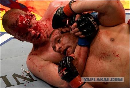 Рихтовка лица вручную: До и после ринга