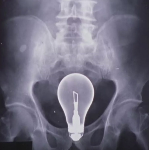 "Его разорвало изнутри": четырехлетний мальчик умер, играя в фонтане на глазах у матери