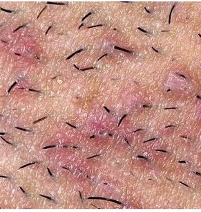 Б*ядская дорожка, или почему опасно дружить с семитскими девочками