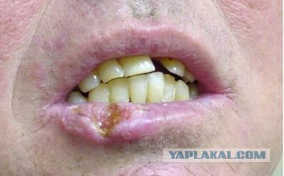 Уроки геноцида на Вятке