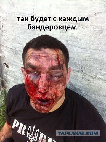 Обычный солдат Украины 2015