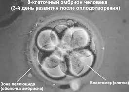 О противниках абортов.