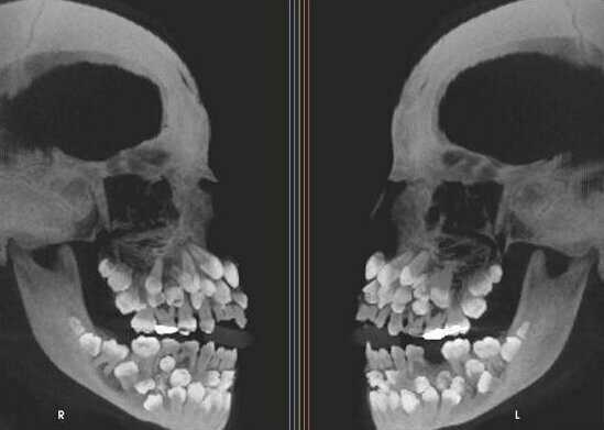 Необычные рентгеновские снимки