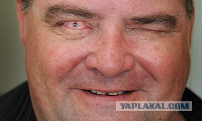 Видеть при помощи зуба? легко!
