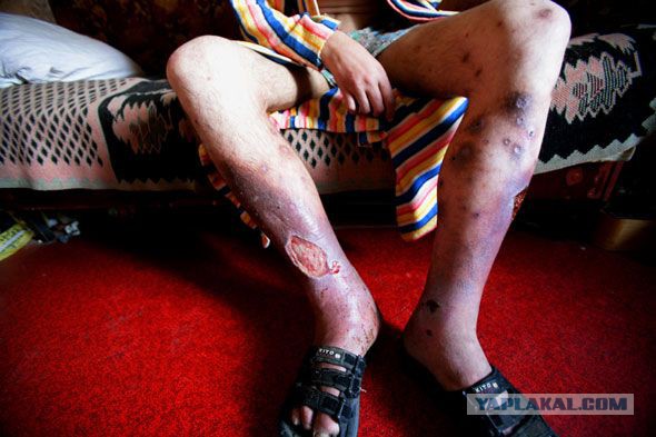 Селфи врачей «скорой» с окровавленным пациентом