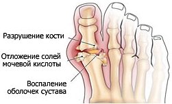 «Золотая молодежь» Азербайджана в соцсетях
