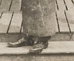 Самые кошмарные медицинские гаджеты прошлого