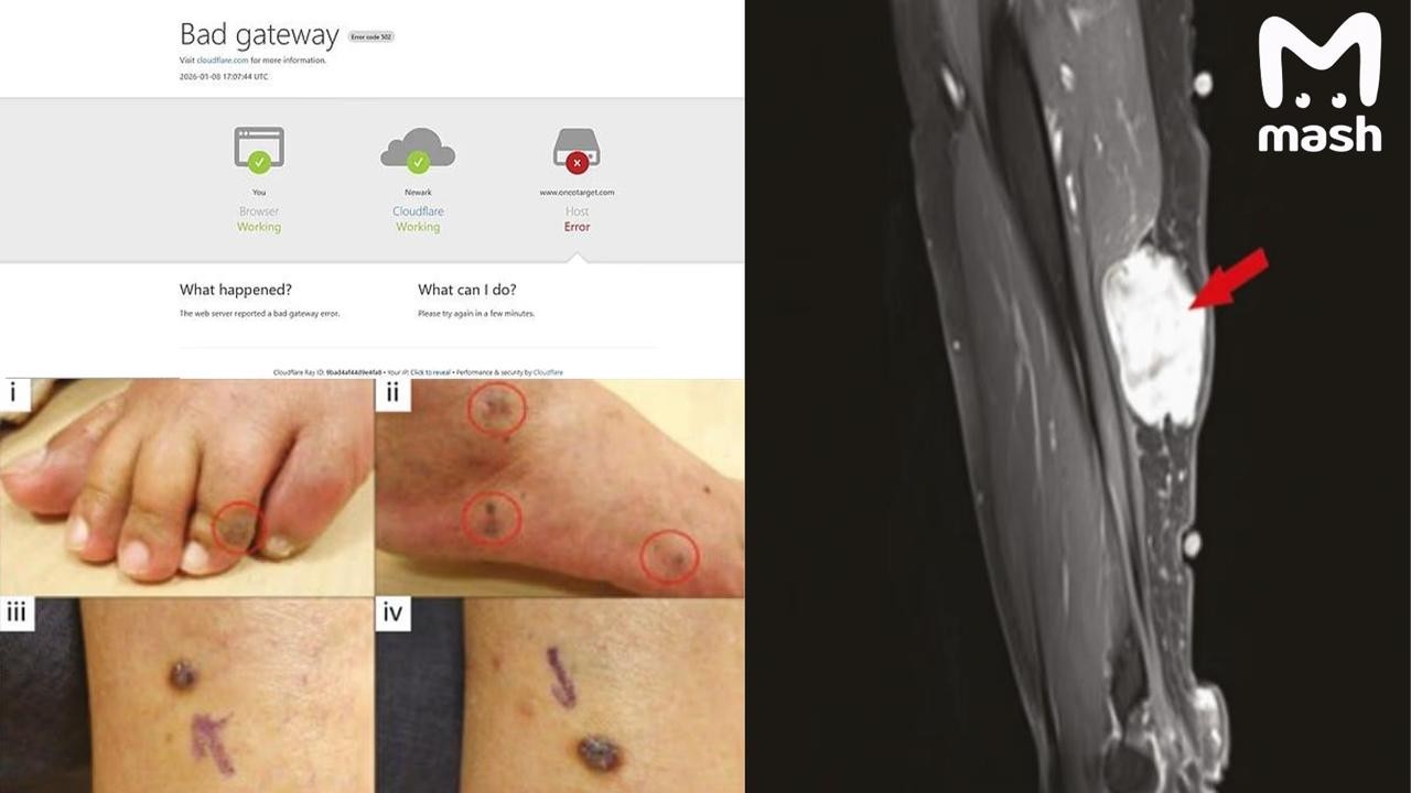 Антиваксеры, ликуйте, — вы были правы