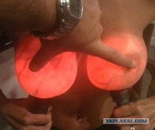 Когда вы минусуете уже заминусованного