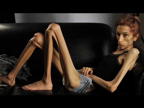 Как меняется лицо и его выражение после сильного похудения