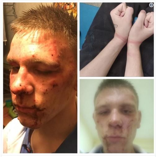 В Петербурге возбудили уголовное дело после пыток подростка в полиции