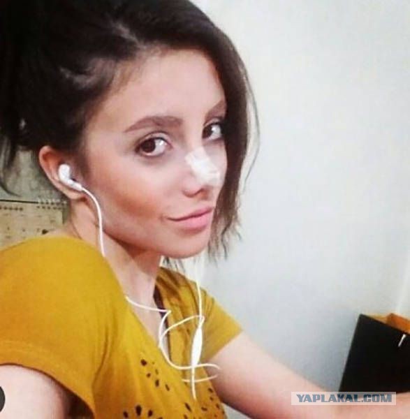 Иранка сделала 50 операций, чтобы быть похожей на Анджелину Джоли