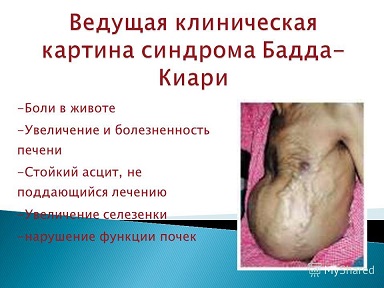 Известную пианистку Анну Коровушкину поймали с героином в Москве