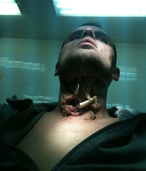 «Я пережил пытки в реанимации и остался инвалидом»