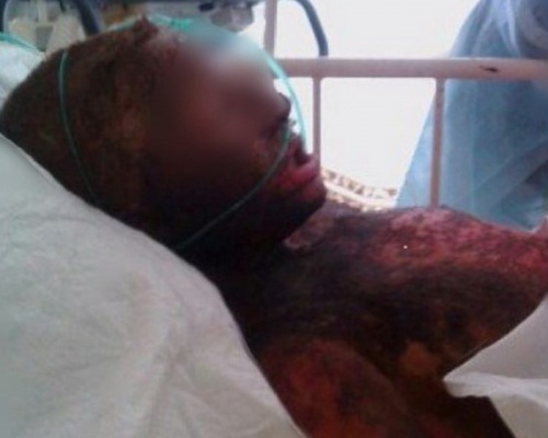 Башкирская школьница получила ожоги всего тела, делая селфи на крыше поезда