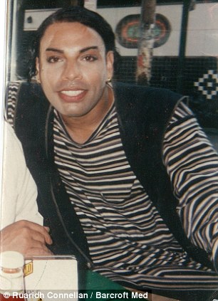 Жертва инъекций бетона показала новое лицо