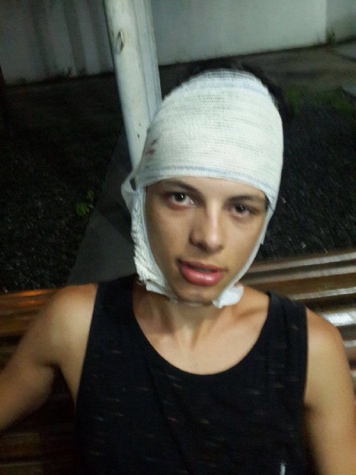 Премия Дарвина разминулась с мозгом идиота на пару миллиметров