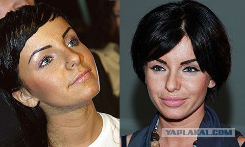 Знаменитости, которые безобразно стареют