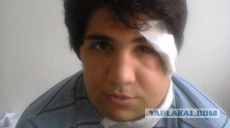 Российского боксера жестоко избили в ночном клубе