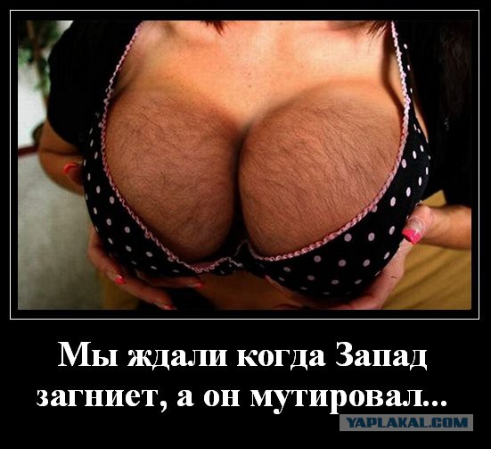 Движение женщин против эпиляции.