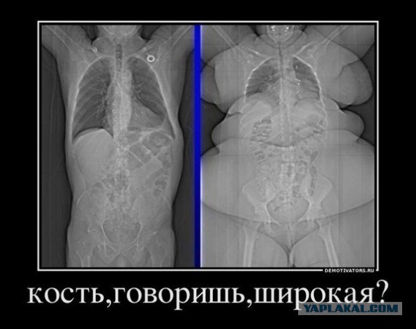 Толстые тётки наступают