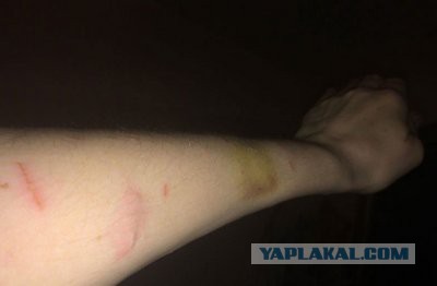 Совушки могут делать кусь. И хвать. Потому что у них ЛАПКИ!