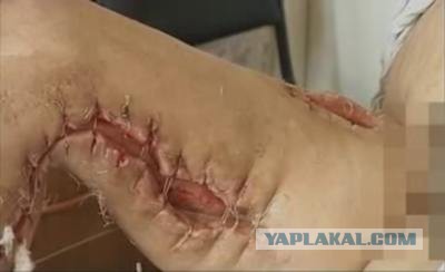 Селфи врачей «скорой» с окровавленным пациентом