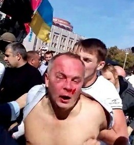Драка у Савика Шустера в прямом эфире