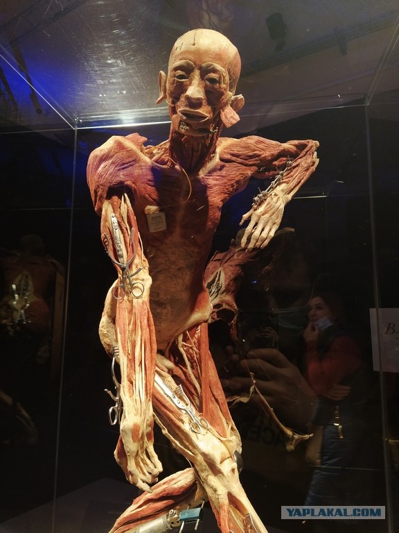 Посетил выставку Body Worlds на ВДНХ