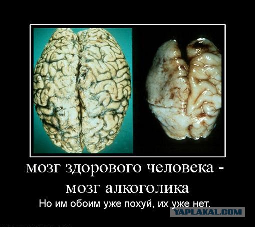 А вот вам: Как влияет алкоголь на мозг.