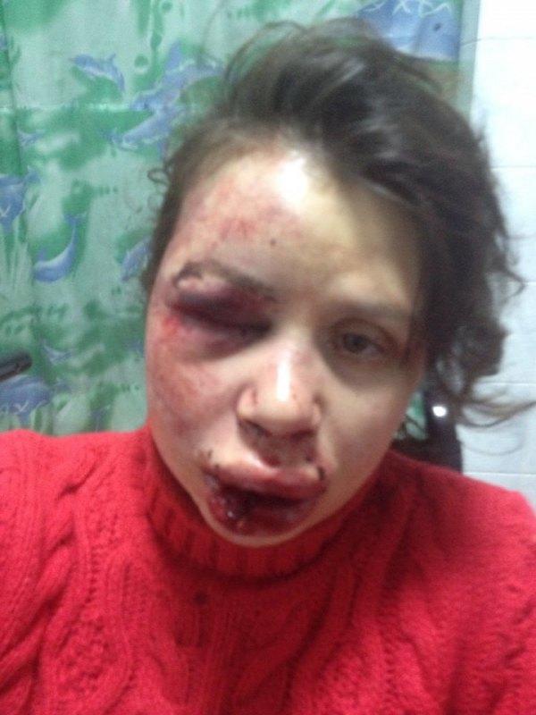 Ремни "опасности"