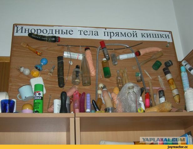 60 сантиметров "удовольствия". Из пациента достали фаллоимитатор с помощью "лассо"