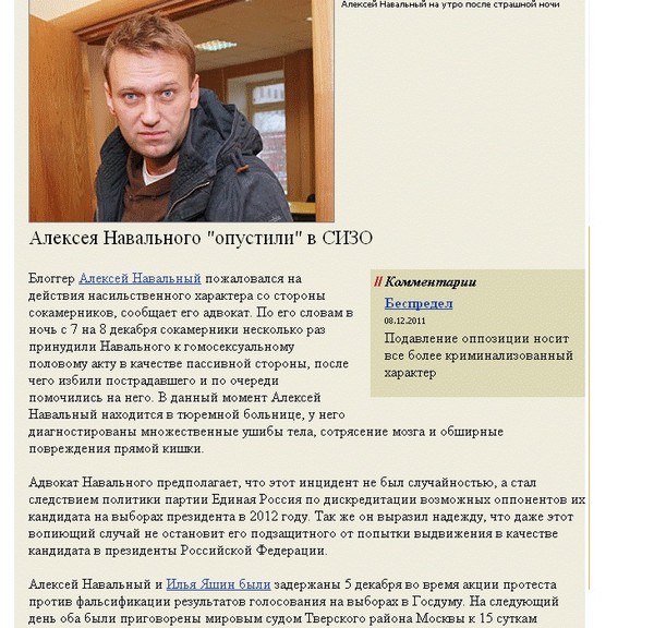 Здоровье Навального ухудшилось. Боли в спине
