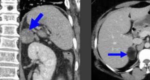 Подросток, который попал в нужные руки