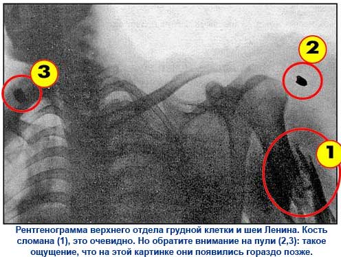 Кем на самом деле была Фанни Каплан, стрелявшая в Ленина?