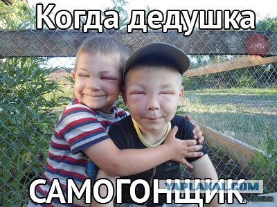 Девушке в глаза попал ядовитый плющ