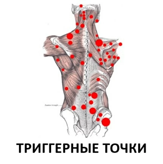 Как мне спину отколотили