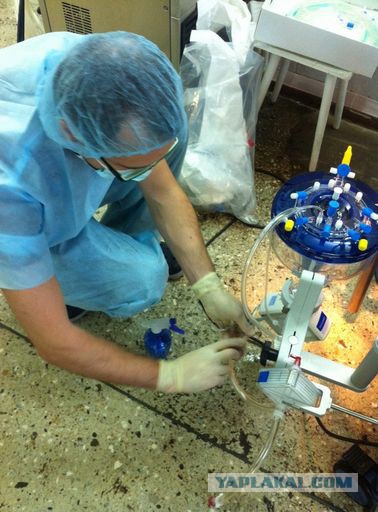 Искусственное кровообращение