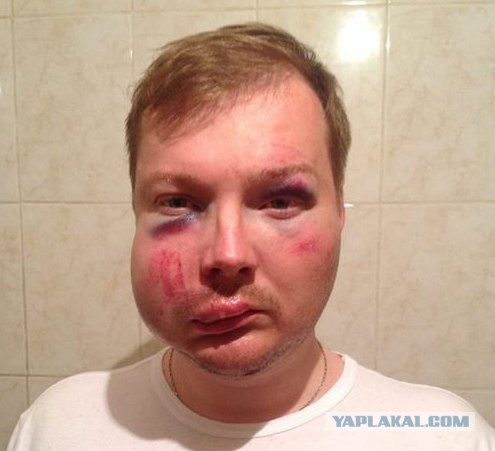 На границе Харьковской области взяли "онижедитэй"