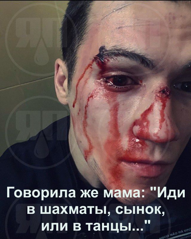 Хулиганы толпой избили бойца ММА в Москве