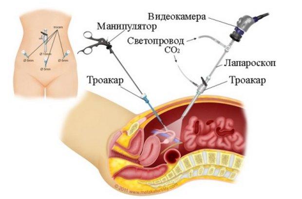 Взбодримся?