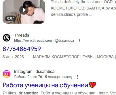 Врач, уволенная за замечание о губах пациентки: «Она сказала, что я морщинистая и дряхлая»