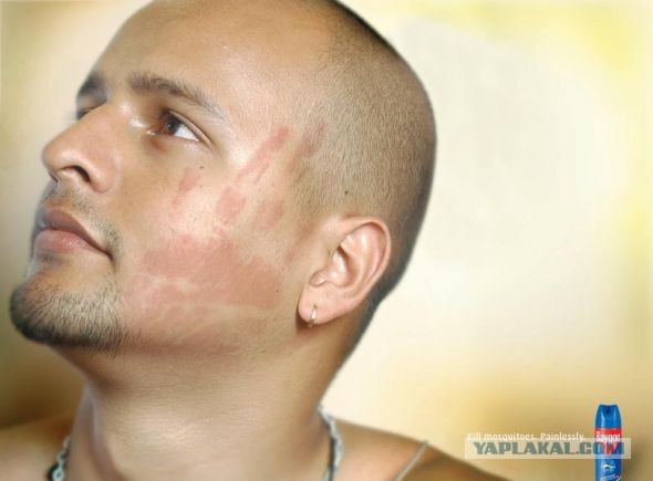 Микроскопический вид комара, который сосет кровь