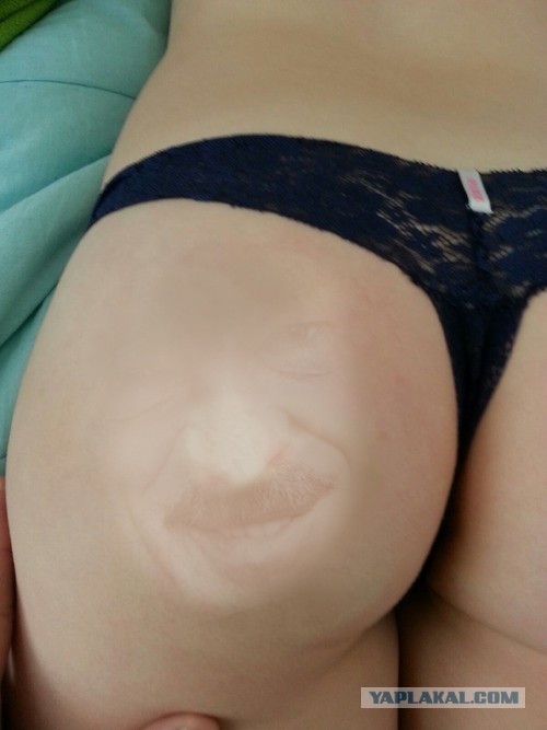 Укусил?