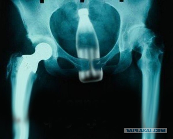 О наболевшем