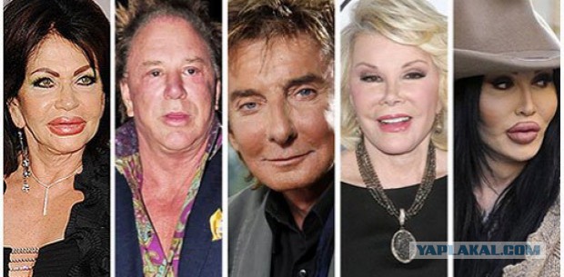 Знаменитости, которые безобразно стареют