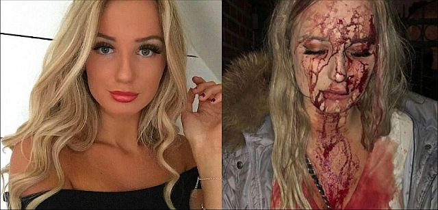Девушке разбили голову бутылкой за то, что она не дала облапать себя в клубе