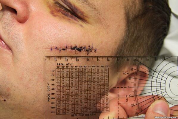 Похищения активистов Беркутом...